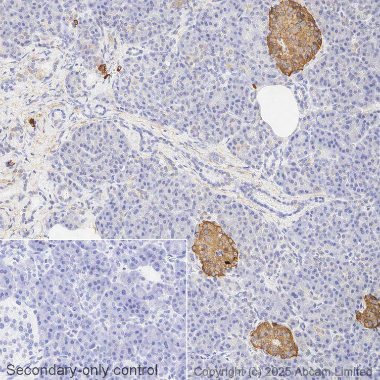 Immunohistochemistry (Formalin/PFA-fixed paraffin-embedded sections) - Biotin Anti-Insulin antibody [EPR3074] (AB323678)