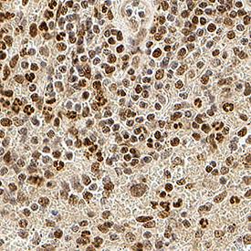 Immunohistochemistry (Formalin/PFA-fixed paraffin-embedded sections) - Biotin Anti-IRE1 (phospho S724) antibody (AB81936)