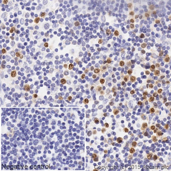Immunohistochemistry (Formalin/PFA-fixed paraffin-embedded sections) - Biotin Anti-IRF4 antibody [EP5699] (AB201482)