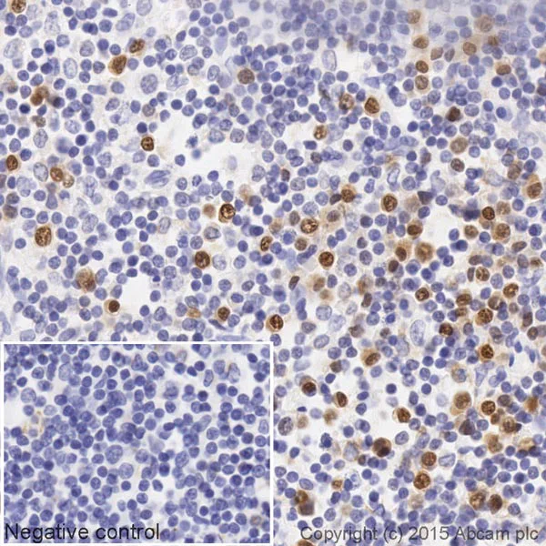 Immunohistochemistry (Formalin/PFA-fixed paraffin-embedded sections) - Biotin Anti-IRF4 antibody [EP5699] (AB201482)