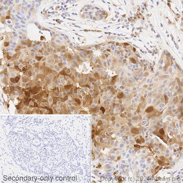 Immunohistochemistry (Formalin/PFA-fixed paraffin-embedded sections) - Biotin Anti-ISG15 antibody [EPR24482-49] (AB317077), expandable thumbnail