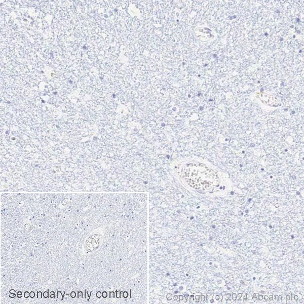 Immunohistochemistry (Formalin/PFA-fixed paraffin-embedded sections) - Biotin Anti-ISG15 antibody [EPR24482-49] (AB317077)