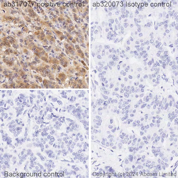 Immunohistochemistry (Formalin/PFA-fixed paraffin-embedded sections) - Biotin Anti-ISG15 antibody [EPR24482-49] (AB317077), expandable thumbnail