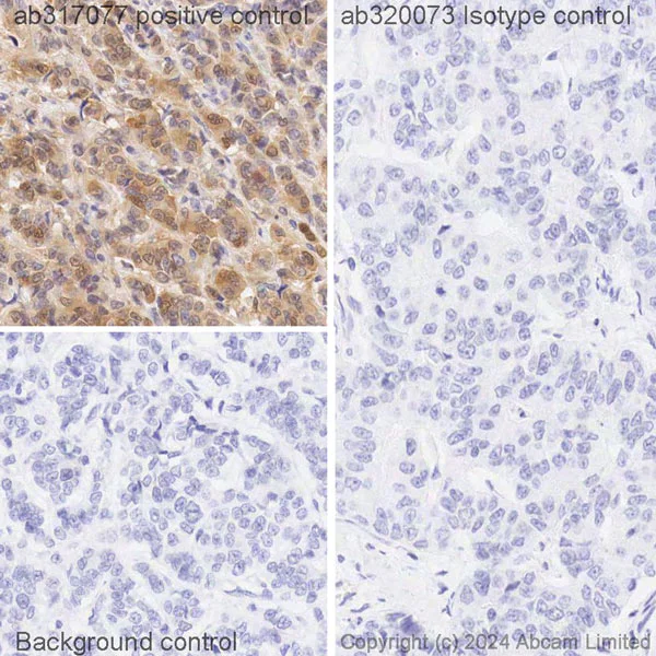 Immunohistochemistry (Formalin/PFA-fixed paraffin-embedded sections) - Biotin Anti-ISG15 antibody [EPR24482-49] (AB317077)