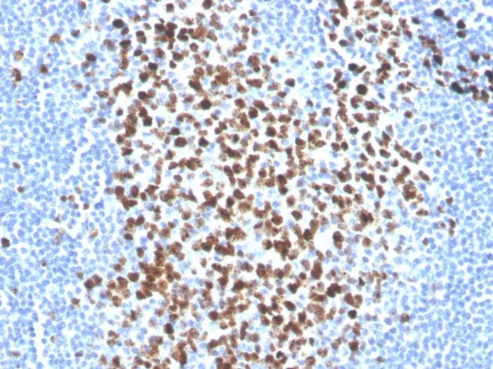 Immunohistochemistry (Formalin/PFA-fixed paraffin-embedded sections) - Biotin Anti-Ki67 antibody [MKI67/2465] (AB271811)
