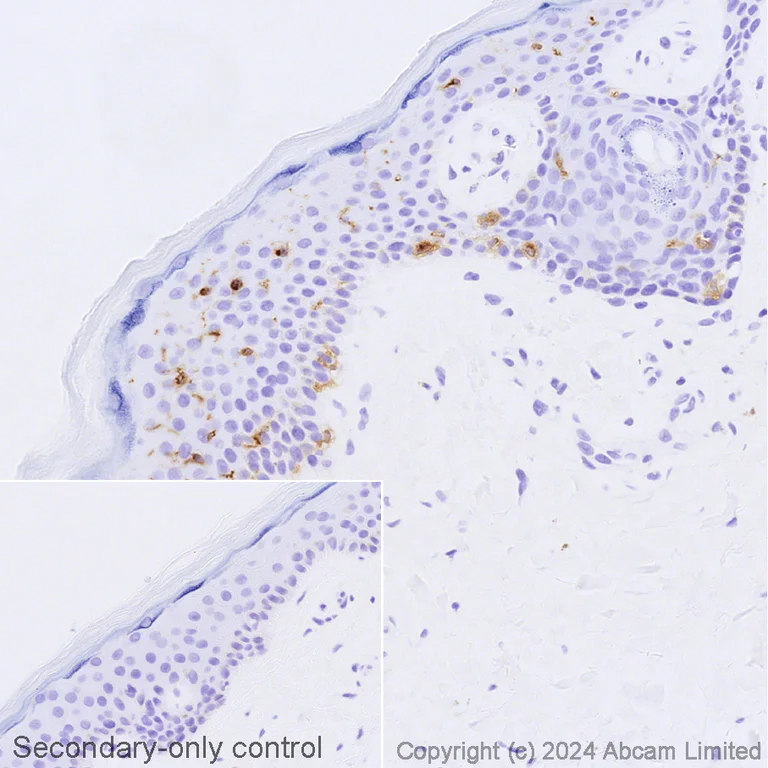 Immunohistochemistry (Formalin/PFA-fixed paraffin-embedded sections) - Biotin Anti-Langerin antibody [EPR15863] (AB322985)