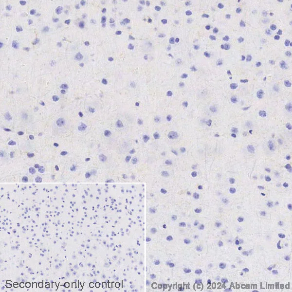 Immunohistochemistry (Formalin/PFA-fixed paraffin-embedded sections) - Biotin Anti-Lipocalin-2 / NGAL [EPR21092] (AB318314)