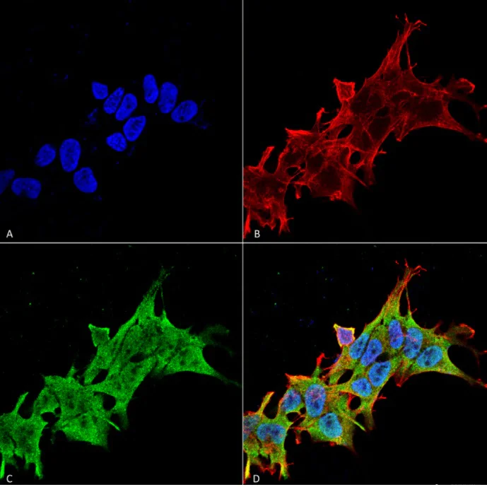 Immunocytochemistry/ Immunofluorescence - Biotin Anti-LRRK2 antibody [N231B/34] (AB186324)