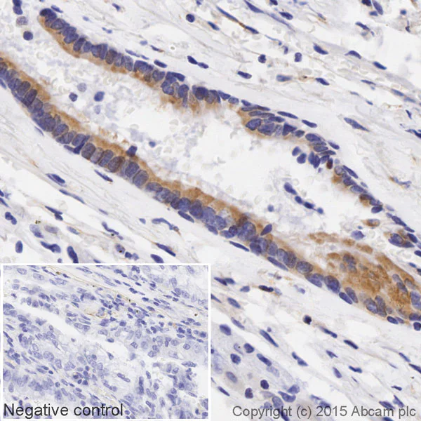 Immunohistochemistry (Formalin/PFA-fixed paraffin-embedded sections) - Biotin Anti-Lumican antibody [EPR8898(2)] (AB201502)