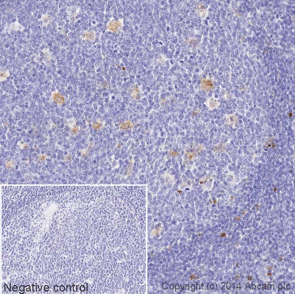 Immunohistochemistry (Formalin/PFA-fixed paraffin-embedded sections) - Biotin Anti-Lysozyme antibody [EPR2994(2)] (AB197704)