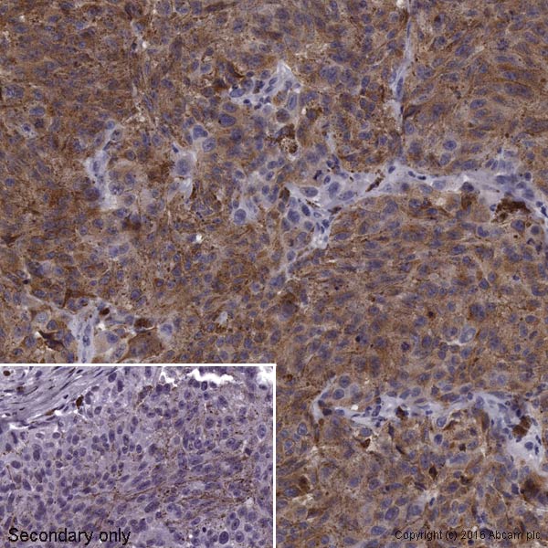 Immunohistochemistry (Formalin/PFA-fixed paraffin-embedded sections) - Biotin Anti-Melanoma gp100 antibody [EP4863(2)] (AB204674), expandable thumbnail