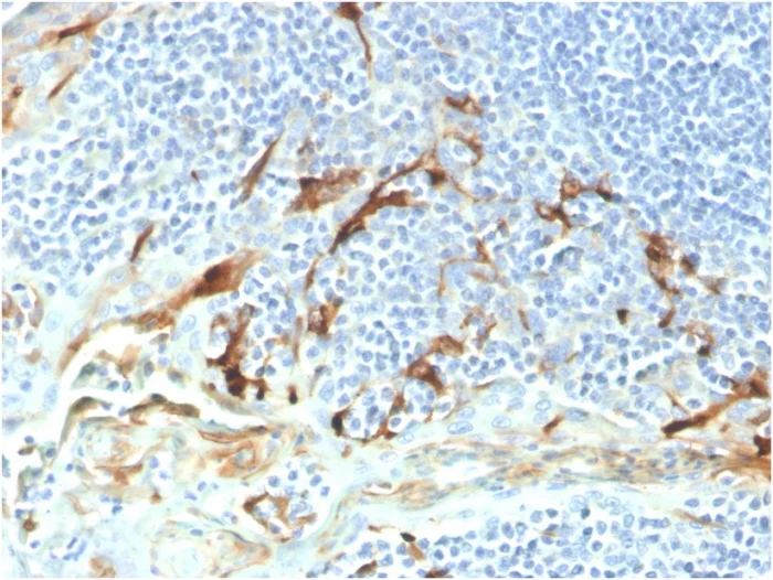 Immunohistochemistry (Formalin/PFA-fixed paraffin-embedded sections) - Biotin Anti-Mesothelin antibody [MSLN/2131] (AB271813)