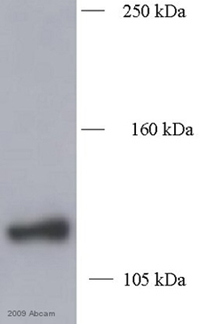 Western blot - Biotin Anti-Myc tag antibody (AB34773), expandable thumbnail