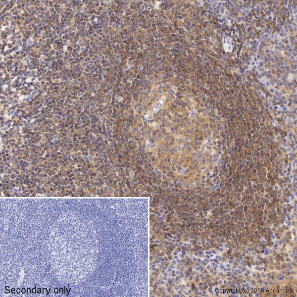 Immunohistochemistry (Formalin/PFA-fixed paraffin-embedded sections) - Biotin Anti-NF-kB p65 antibody [E379] (AB205823), expandable thumbnail