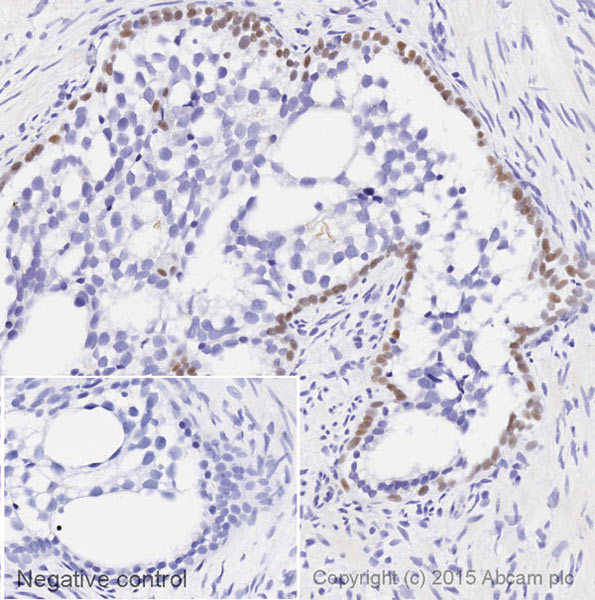 Immunohistochemistry (Formalin/PFA-fixed paraffin-embedded sections) - Biotin Anti-p63 antibody [EPR5701] (AB202861), expandable thumbnail