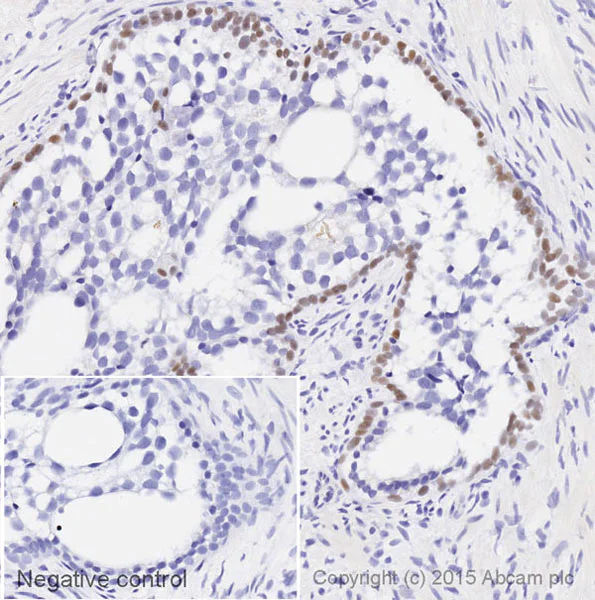 Immunohistochemistry (Formalin/PFA-fixed paraffin-embedded sections) - Biotin Anti-p63 antibody [EPR5701] (AB202861)