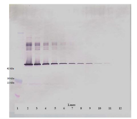 Western blot - Biotin Anti-PAI1 antibody (AB271234), expandable thumbnail