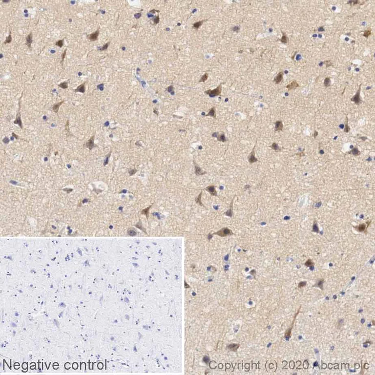 Immunohistochemistry (Formalin/PFA-fixed paraffin-embedded sections) - Biotin Anti-Pan Trk antibody [EPR17341] (AB252166)