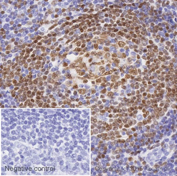 Immunohistochemistry (Formalin/PFA-fixed paraffin-embedded sections) - Biotin Anti-PAX5 antibody [EPR3730(2)] (AB202956)