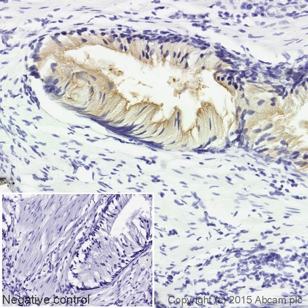 Immunohistochemistry (Formalin/PFA-fixed paraffin-embedded sections) - Biotin Anti-PSMA antibody [EPR6253] (AB201253), expandable thumbnail