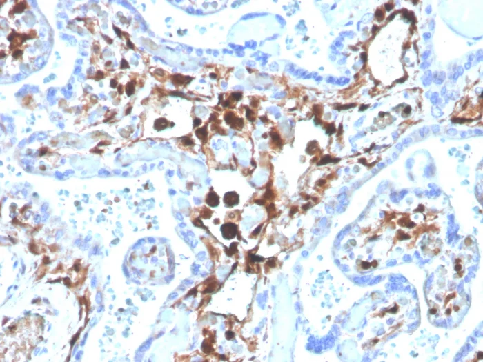 Immunohistochemistry (Formalin/PFA-fixed paraffin-embedded sections) - Biotin Anti-S100A4 antibody [S100A4/1481] (AB271820)