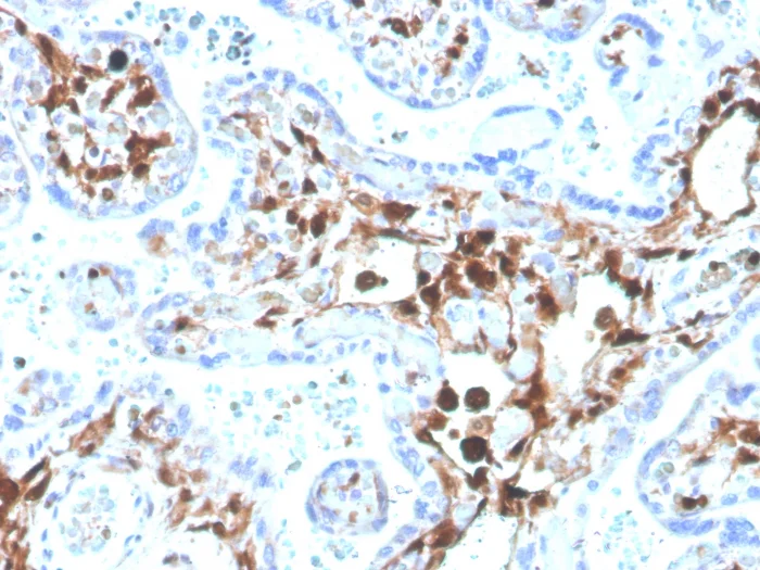 Immunohistochemistry (Formalin/PFA-fixed paraffin-embedded sections) - Biotin Anti-S100A4 antibody [S100A4/1481] (AB271820)
