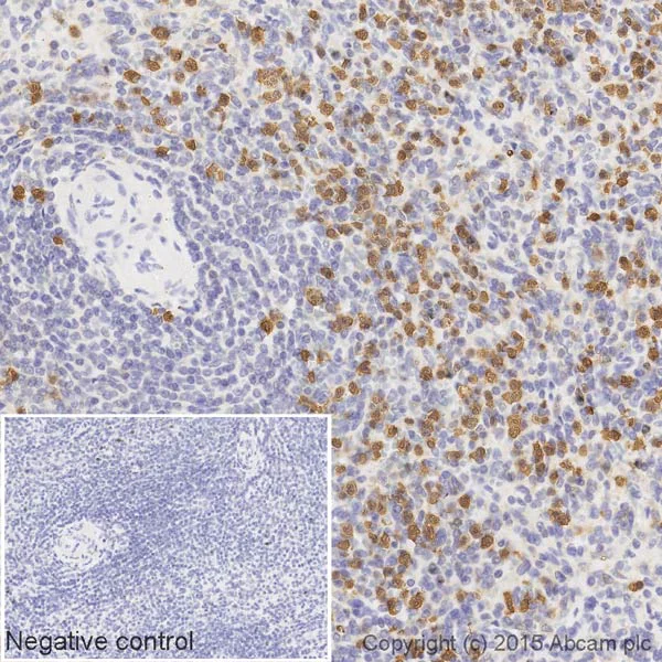 Immunohistochemistry (Formalin/PFA-fixed paraffin-embedded sections) - Biotin Anti-S100A8 antibody [EPR3554] (AB201474)