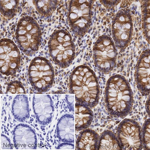 Immunohistochemistry (Formalin/PFA-fixed paraffin-embedded sections) - Biotin Anti-SDHB antibody [EPR10880] (AB198330)