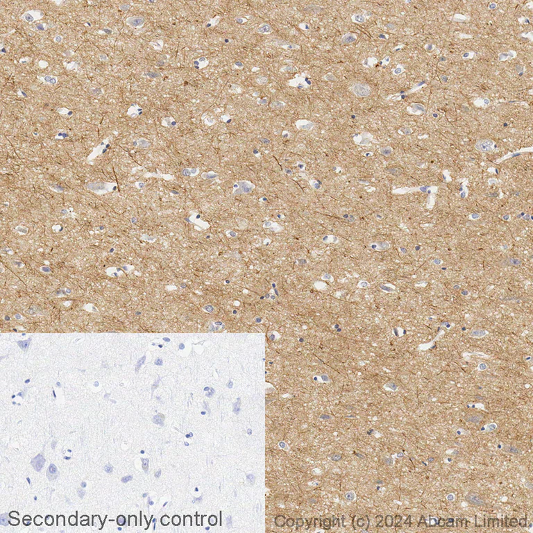 Immunohistochemistry (Formalin/PFA-fixed paraffin-embedded sections) - Biotin Anti-Tau (phospho S396) antibody [E178] (AB322984)