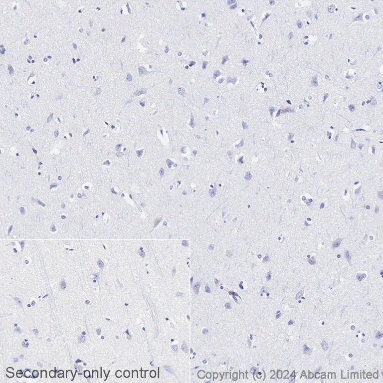 Immunohistochemistry (Formalin/PFA-fixed paraffin-embedded sections) - Biotin Anti-Tau (phospho S396) antibody [E178] (AB322984)