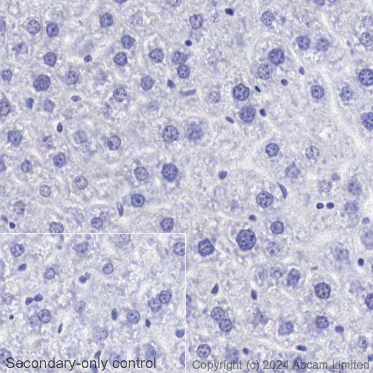 Immunohistochemistry (Formalin/PFA-fixed paraffin-embedded sections) - Biotin Anti-Tau (phospho S396) antibody [EPR2731] (AB322982)