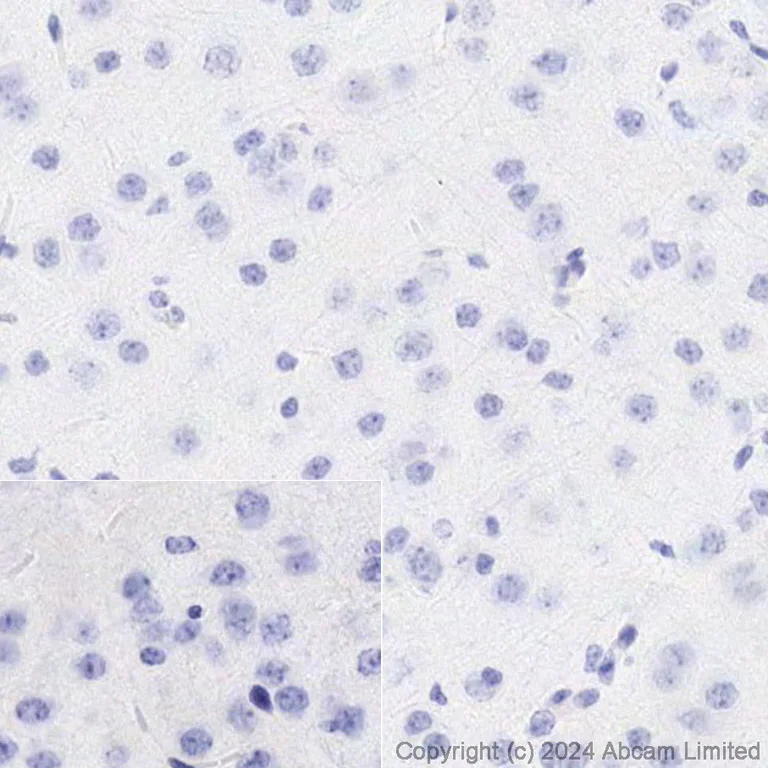 Immunohistochemistry (Formalin/PFA-fixed paraffin-embedded sections) - Biotin Anti-Tau (phospho S396) antibody [EPR2731] (AB322982)