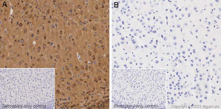 Immunohistochemistry (Formalin/PFA-fixed paraffin-embedded sections) - Biotin Anti-Tau (phospho T205) antibody [EPR23505-13] (AB314404)