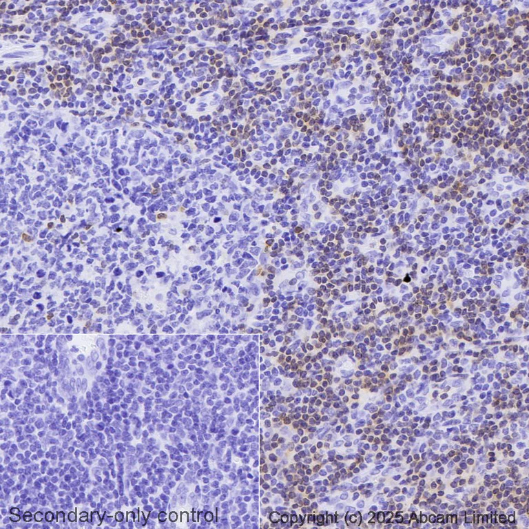 Immunohistochemistry (Formalin/PFA-fixed paraffin-embedded sections) - Biotin Anti-TCR beta antibody [EPR24928-66] (AB323531)