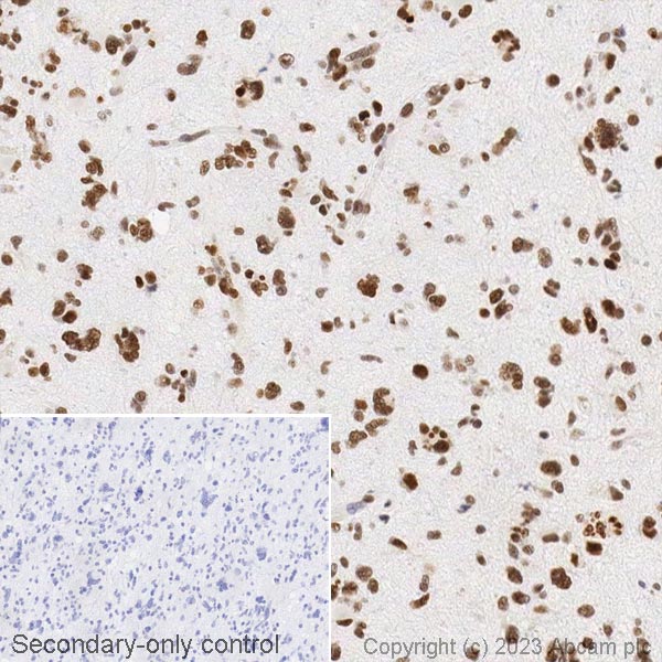 Immunohistochemistry (Formalin/PFA-fixed paraffin-embedded sections) - Biotin Anti-TDP43 antibody [EPR5810] (AB314265), expandable thumbnail