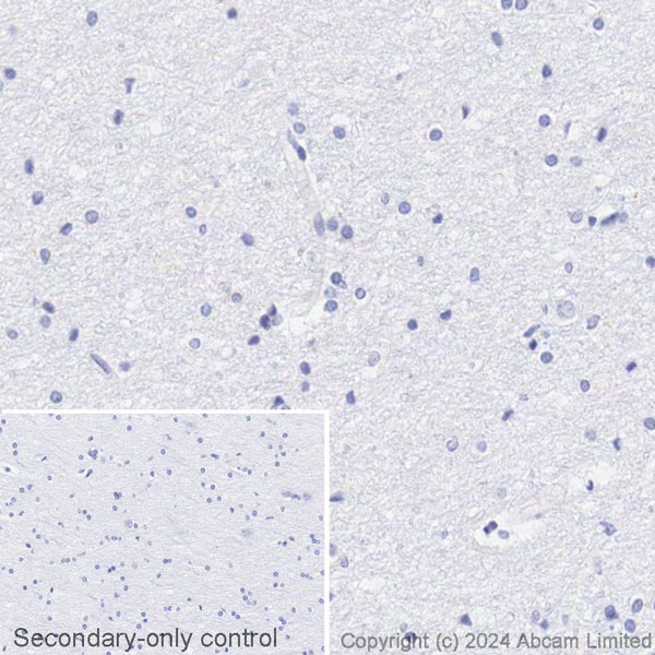 Immunohistochemistry (Formalin/PFA-fixed paraffin-embedded sections) - Biotin Anti-TIMP1 antibody [EPR18352] (AB317768), expandable thumbnail