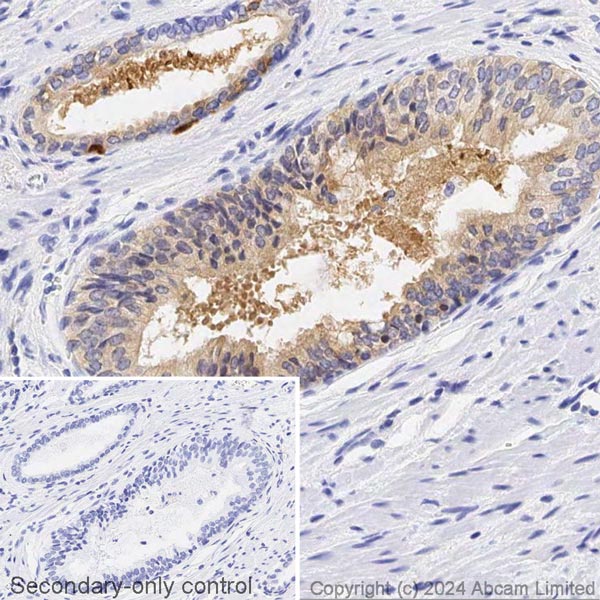 Immunohistochemistry (Formalin/PFA-fixed paraffin-embedded sections) - Biotin Anti-TIMP1 antibody [EPR18352] (AB317768), expandable thumbnail