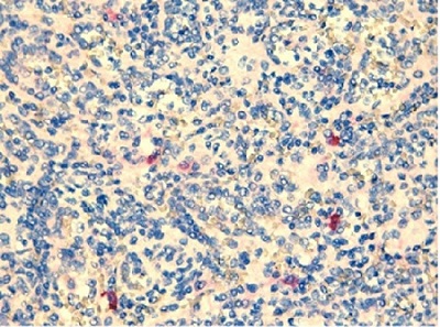 Immunohistochemistry (Formalin/PFA-fixed paraffin-embedded sections) - Biotin Anti-TLR2 antibody [TL2.1] (AB9101)