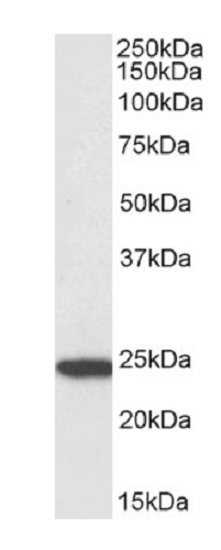 Western blot - Biotin Anti-TMS1/ASC antibody - C-terminal (AB240495), expandable thumbnail