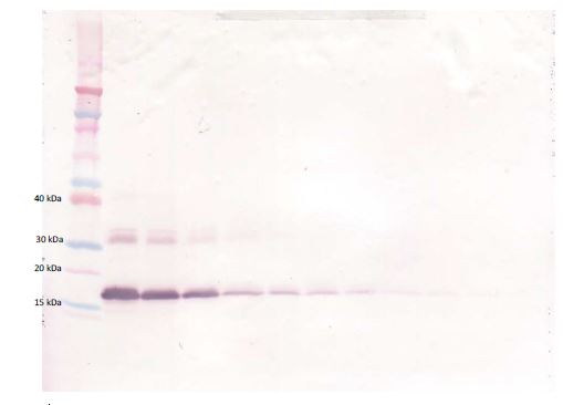 Western blot - Biotin Anti-TNF Receptor I antibody (AB271211), expandable thumbnail