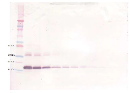 Western blot - Biotin Anti-TNF Receptor I antibody (AB271211)
