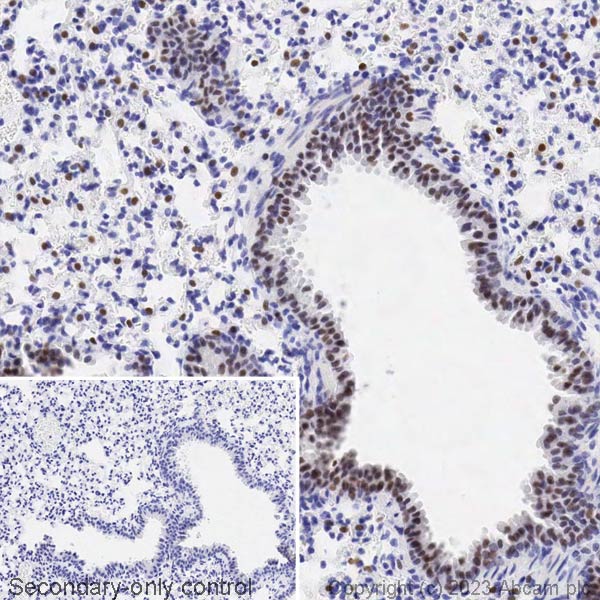 Immunohistochemistry (Formalin/PFA-fixed paraffin-embedded sections) - Biotin Anti-TTF1/Nkx2-1 antibody [EP1584Y] (AB314937), expandable thumbnail
