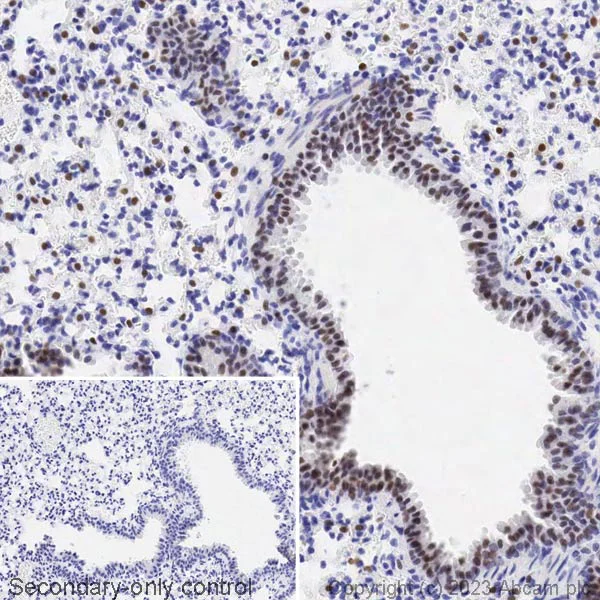 Immunohistochemistry (Formalin/PFA-fixed paraffin-embedded sections) - Biotin Anti-TTF1/Nkx2-1 antibody [EP1584Y] (AB314937)