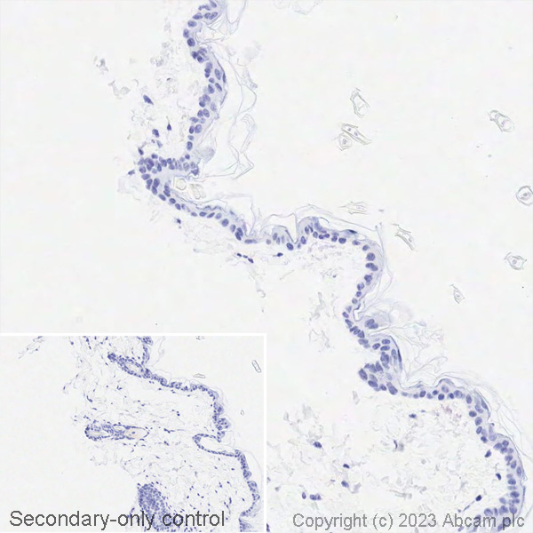 Immunohistochemistry (Formalin/PFA-fixed paraffin-embedded sections) - Biotin Anti-TTF1/Nkx2-1 antibody [EP1584Y] (AB314937), expandable thumbnail