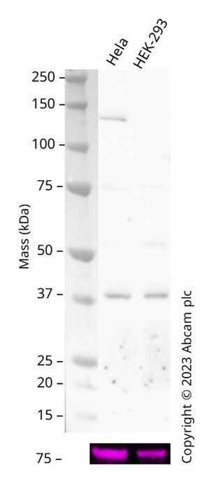 Western blot - Biotin Anti-TTF1/Nkx2-1 antibody [EP1584Y] (AB314937), expandable thumbnail