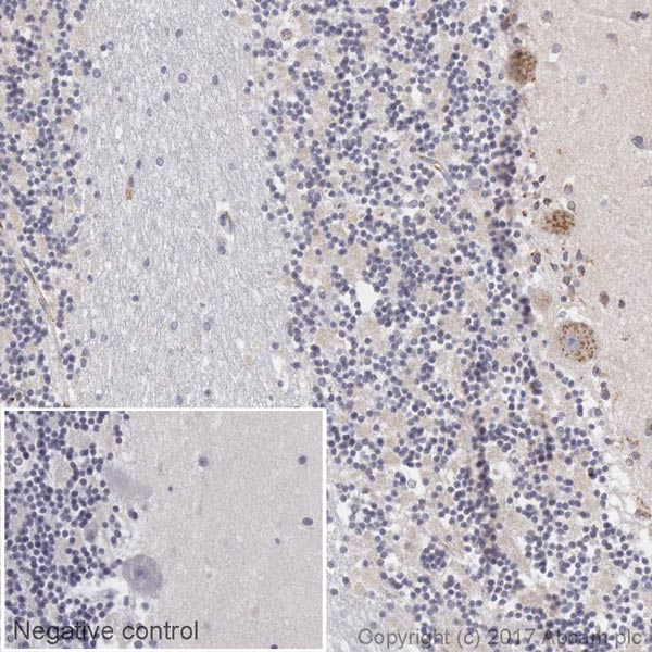 Immunohistochemistry (Formalin/PFA-fixed paraffin-embedded sections) - Biotin Anti-VEGFA antibody [EP1176Y] (AB195902), expandable thumbnail