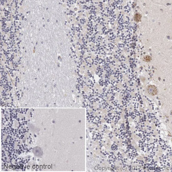 Immunohistochemistry (Formalin/PFA-fixed paraffin-embedded sections) - Biotin Anti-VEGFA antibody [EP1176Y] (AB195902)