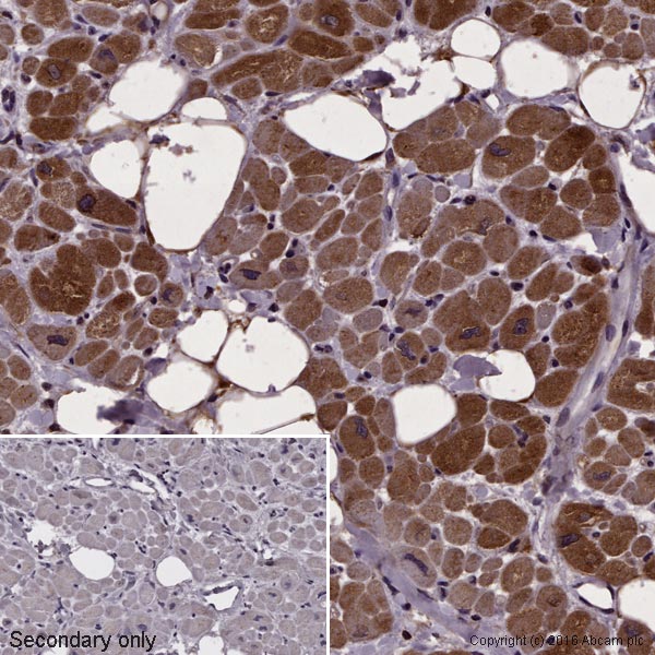 Immunohistochemistry (Formalin/PFA-fixed paraffin-embedded sections) - Biotin Anti-VEGFD antibody [EPR8457] (AB204679), expandable thumbnail