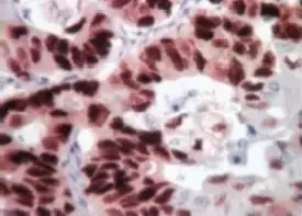 Immunohistochemistry (Formalin/PFA-fixed paraffin-embedded sections) - Biotinylated Goat anti-Mouse & Rabbit IgG (H+L) (Ready To Use) (AB64257)