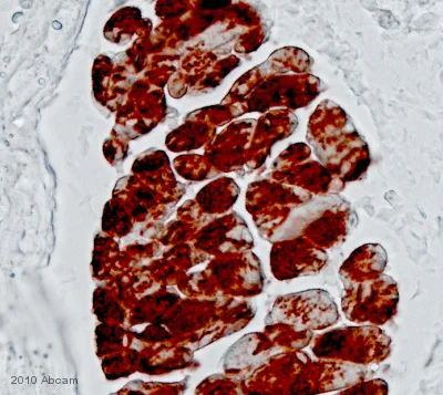 Immunohistochemistry (Formalin/PFA-fixed paraffin-embedded sections) - Biotinylated Goat Anti-Rabbit IgG (H+L) (Ready to use) (AB64256)